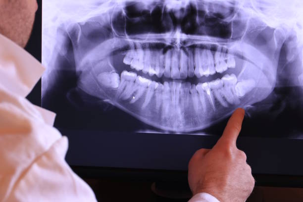 Best Emergency Tooth Extraction in Harbor Springs, MI